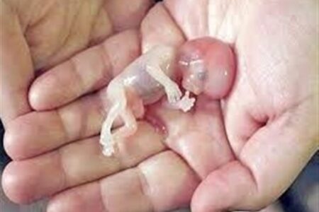 صدور کیفرخواست برای 9 متهم پرونده سقط جنین غیرقانونی در گلستان